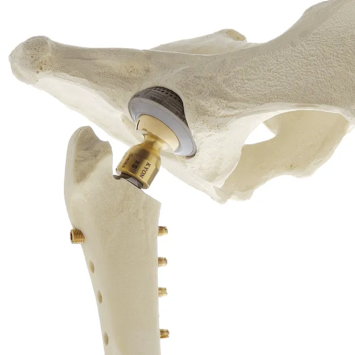 Bone, Joint and Spine Clinic Picture 9