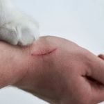 How to Prevent Dog Bites and Cat Scratches: Safety Tips for Families