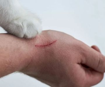 How to Prevent Dog Bites and Cat Scratches: Safety Tips for Families