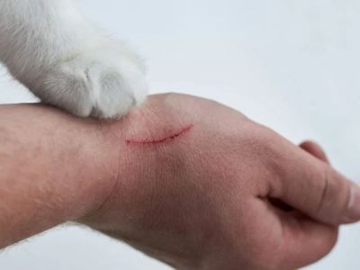 How to Prevent Dog Bites and Cat Scratches: Safety Tips for Families